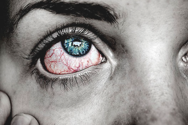 патология глаз